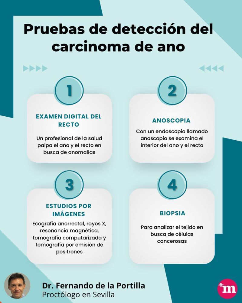 Pruebas carcinoma de ano - Fernando de la Portilla