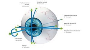 Cirugía refractiva con Láser Amaris 1050 RS: innovación y precisión en corrección visual