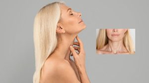 La importancia de las fotos reales de antes y después en el lifting de cuello