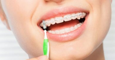 Brackets de zafiro