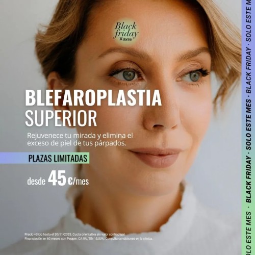 Blefaroplastia Oferta Dorsia