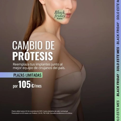 Cambio de prótesis mamarias - Oferta Dorsia