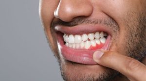 Encías sanas: más allá del sangrado y los falsos mitos