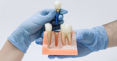 implantes dentales de carga inmediata