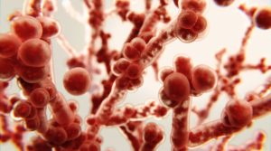 Candidiasis en verano: cómo evitar que este “invitado inesperado” arruine tus vacaciones