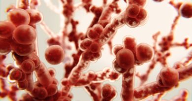 Candidiasis