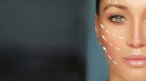 Lifting facial: ¿Cómo es el postoperatorio y qué esperar tras la cirugía?