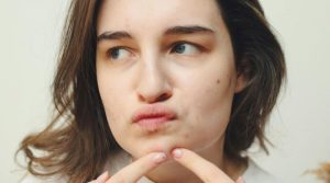 El acné no un simple «problema estético», es una patología médica