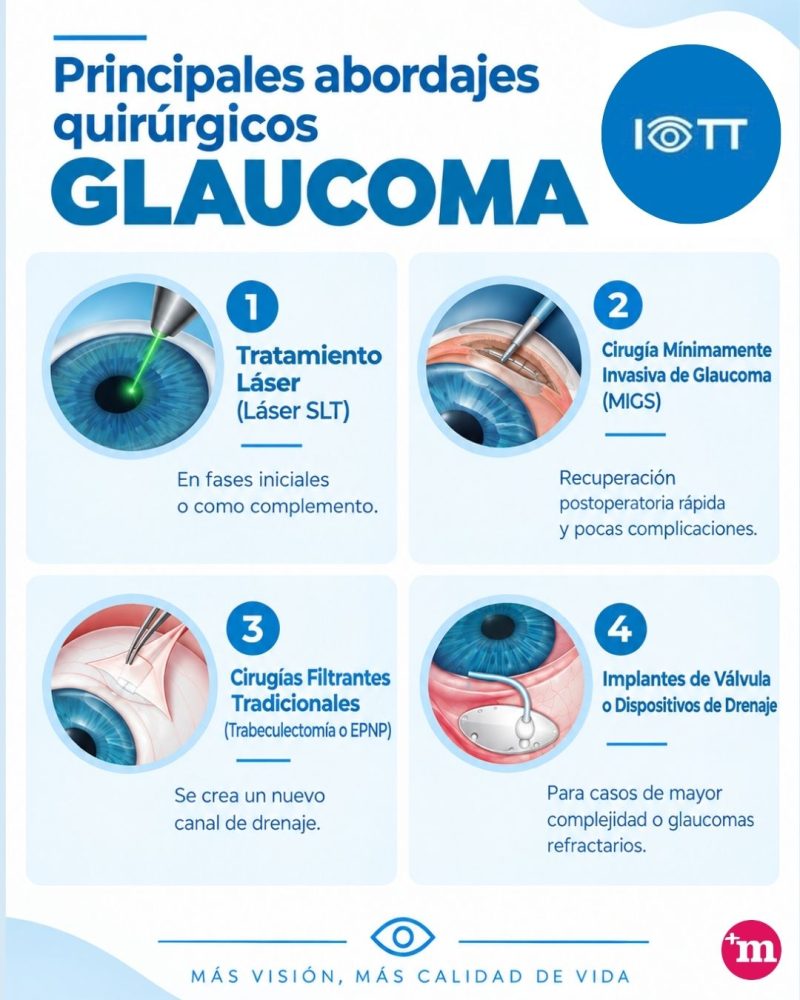 Glaucoma - cirugía