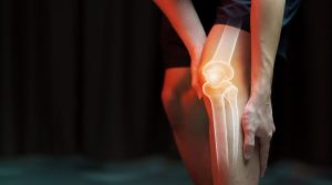 Arthrosamid®: Tratamiento de la Artrosis de Rodilla sin Cirugía con Hidrogel Intraarticular