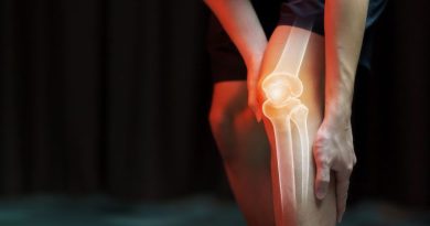 Arthrosamid Tratamiento de la Artrosis de Rodilla